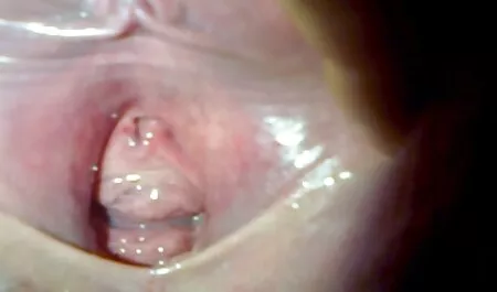 Oral youporn lesbian sex deep blowjob